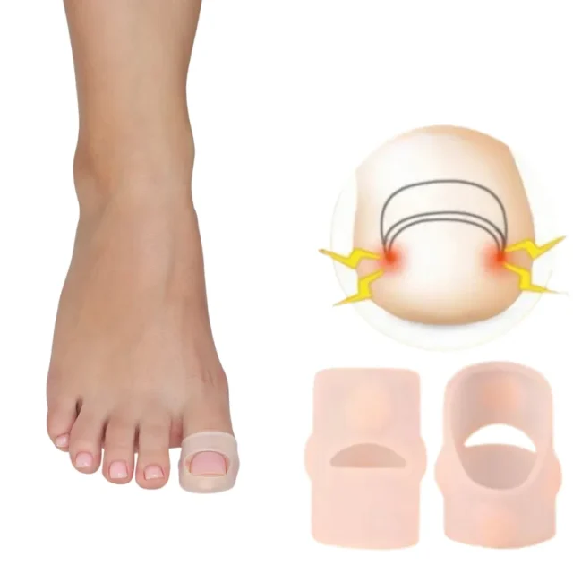 FOOTLOVE Nakładki silikonowe na wrastający paznokieć N75 2 sztuki