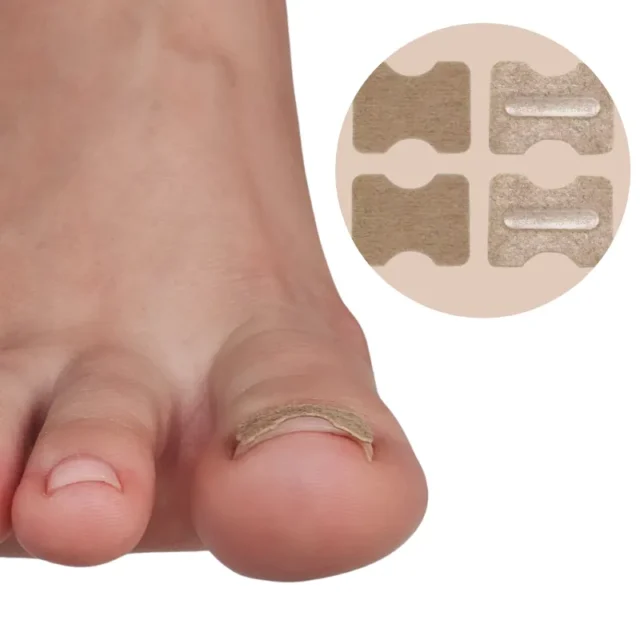 FOOTLOVE Plastry na wrastające paznokcie N67 10 sztuk